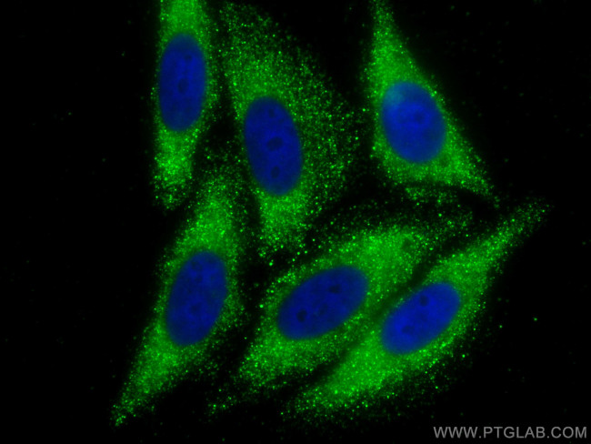 RBP5 Antibody in Immunocytochemistry (ICC/IF)
