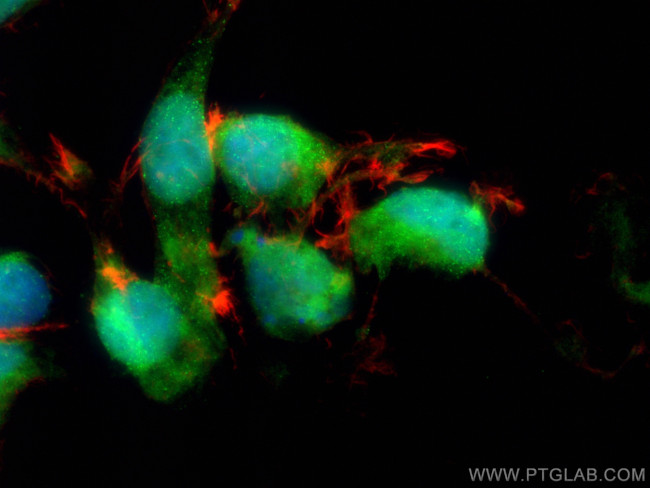 PIN1 Antibody in Immunocytochemistry (ICC/IF)