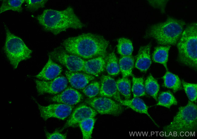 ATP5J2 Antibody in Immunocytochemistry (ICC/IF)