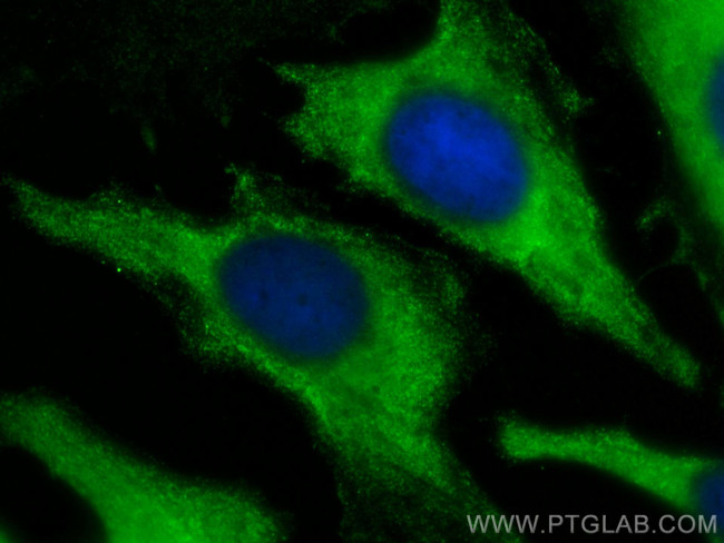 PFKP Antibody in Immunocytochemistry (ICC/IF)