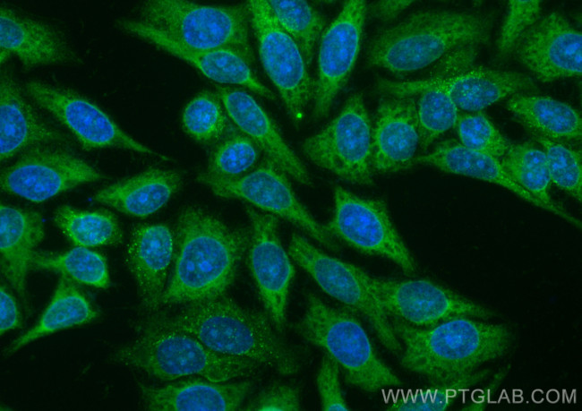 MYDGF/C19orf10 Antibody in Immunocytochemistry (ICC/IF)