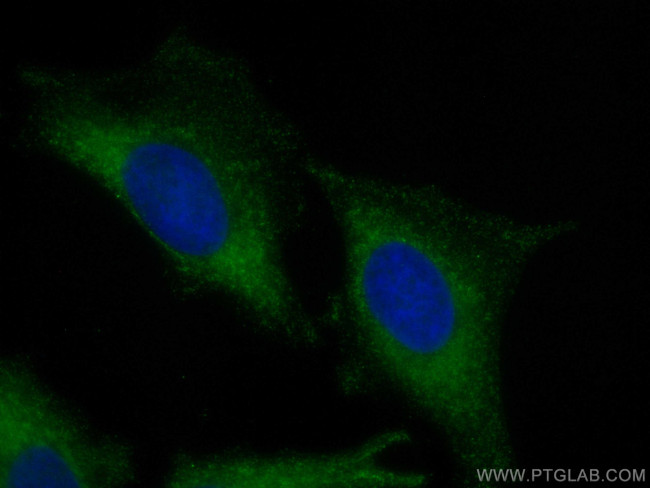 PLA2G4A Antibody in Immunocytochemistry (ICC/IF)
