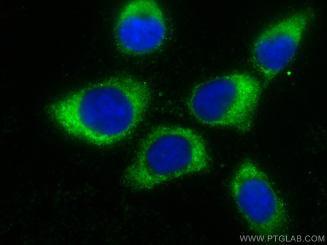 UBE2D1/2/3/4 Antibody in Immunocytochemistry (ICC/IF)