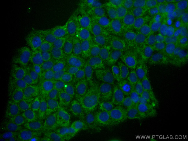 TACSTD2/TROP2 Antibody in Immunocytochemistry (ICC/IF)