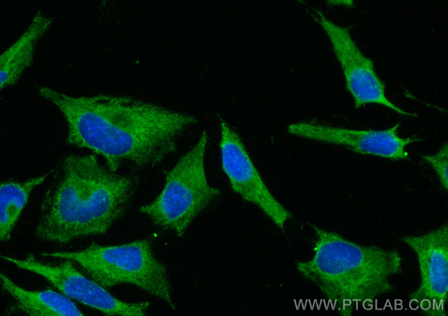 MYL6 Antibody in Immunocytochemistry (ICC/IF)