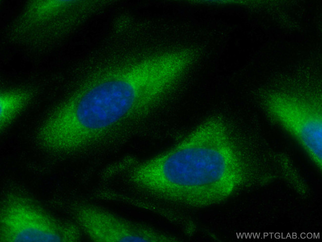 HBS1L Antibody in Immunocytochemistry (ICC/IF)