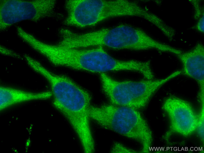 ENO3 Antibody in Immunocytochemistry (ICC/IF)