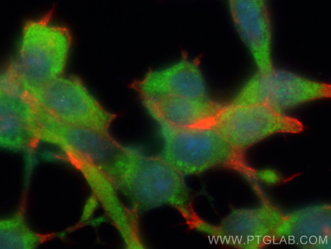 DOHH Antibody in Immunocytochemistry (ICC/IF)