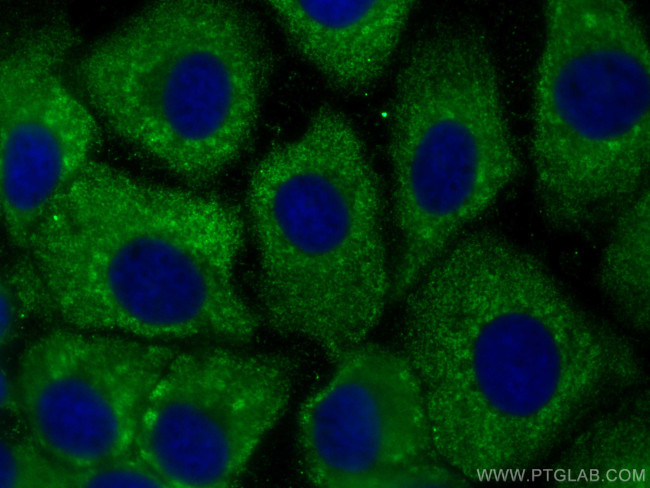 AIDA Antibody in Immunocytochemistry (ICC/IF)