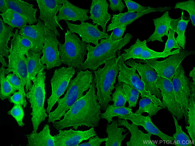 GNAI3 Antibody in Immunocytochemistry (ICC/IF)