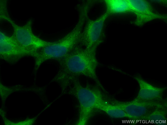 CACYBP Antibody in Immunocytochemistry (ICC/IF)