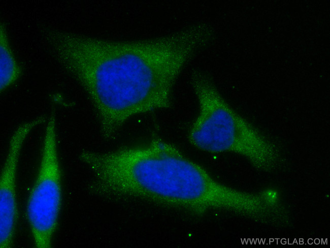 FH Antibody in Immunocytochemistry (ICC/IF)