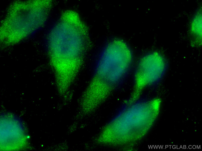 NIT2 Antibody in Immunocytochemistry (ICC/IF)