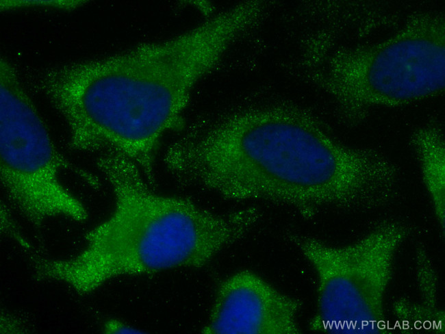 PPA1 Antibody in Immunocytochemistry (ICC/IF)
