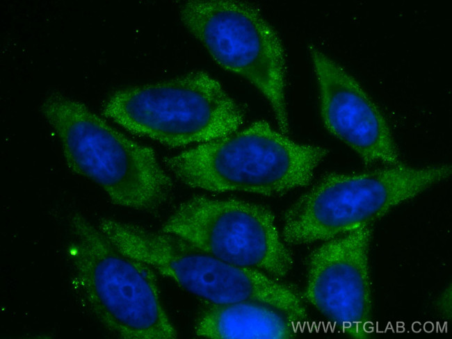 PSMB2 Antibody in Immunocytochemistry (ICC/IF)
