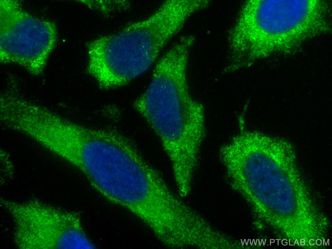 TCP1 Antibody in Immunocytochemistry (ICC/IF)
