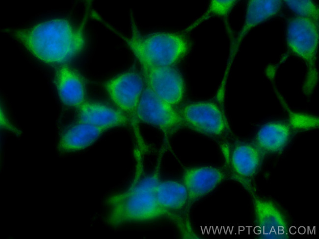 ARL8A/ARL8B Antibody in Immunocytochemistry (ICC/IF)