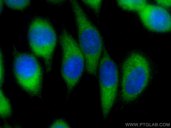 CAPZB Antibody in Immunocytochemistry (ICC/IF)