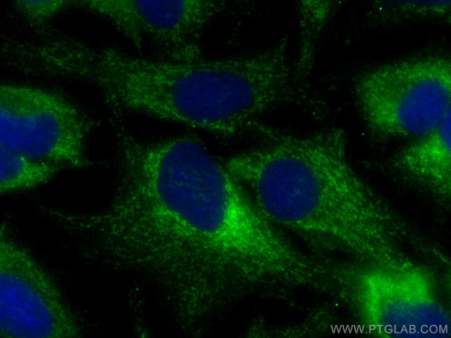 NNT Antibody in Immunocytochemistry (ICC/IF)