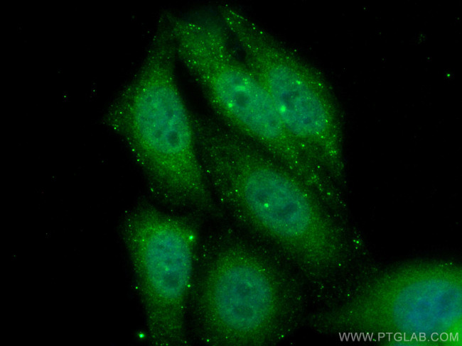 APPL1 Antibody in Immunocytochemistry (ICC/IF)