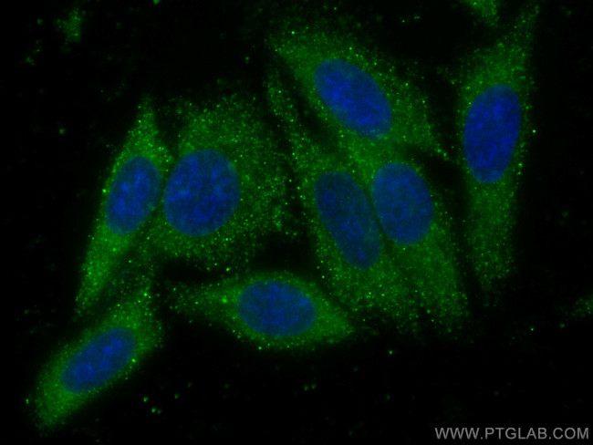 VPS25 Antibody in Immunocytochemistry (ICC/IF)