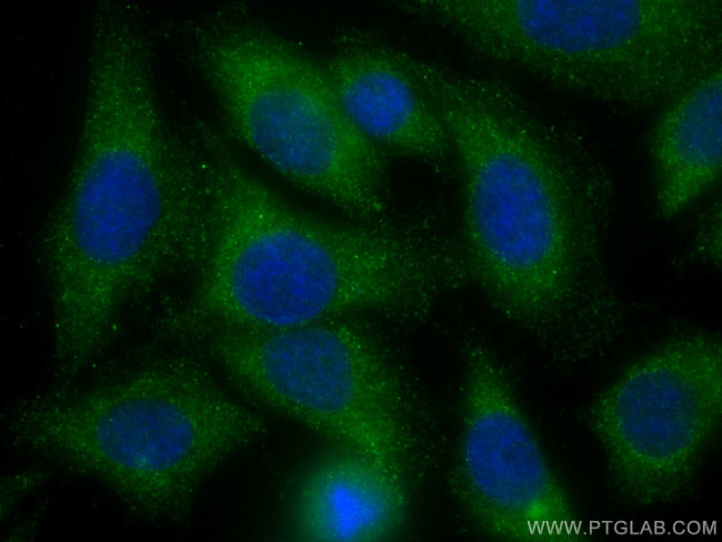 ARF4 Antibody in Immunocytochemistry (ICC/IF)
