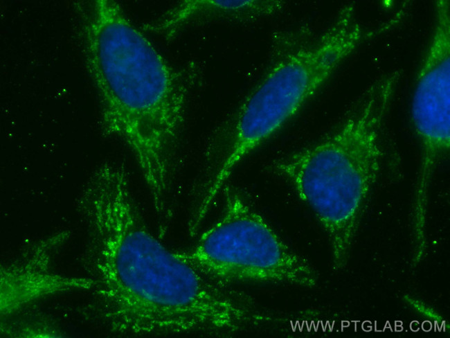 LETM1 Antibody in Immunocytochemistry (ICC/IF)