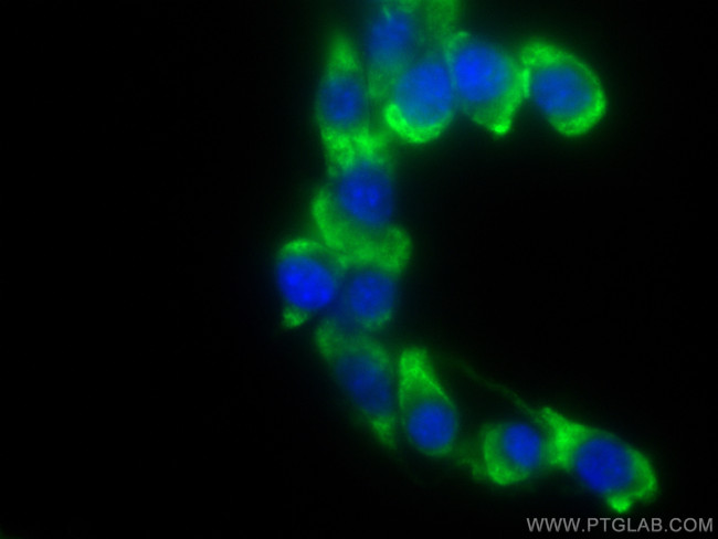 CCT2 Antibody in Immunocytochemistry (ICC/IF)