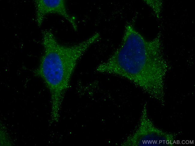 eRF3a/GSPT1 Antibody in Immunocytochemistry (ICC/IF)