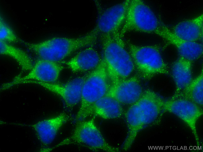ATP6V1B1 Antibody in Immunocytochemistry (ICC/IF)
