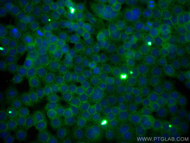 CD59 Antibody in Immunocytochemistry (ICC/IF)