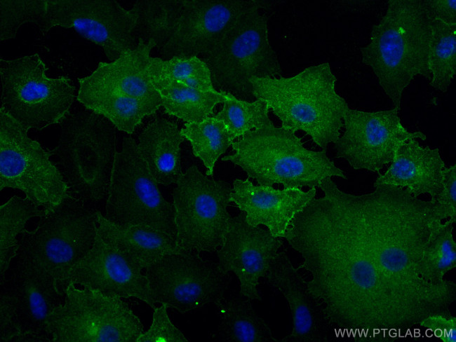 CA12 Antibody in Immunocytochemistry (ICC/IF)