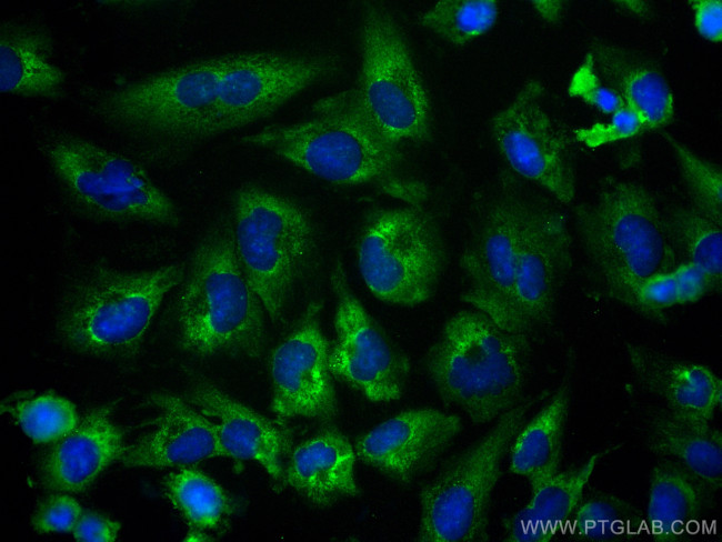 calcyphosine Antibody in Immunocytochemistry (ICC/IF)