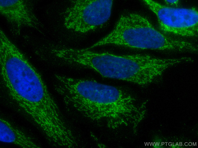 IMMT Antibody in Immunocytochemistry (ICC/IF)