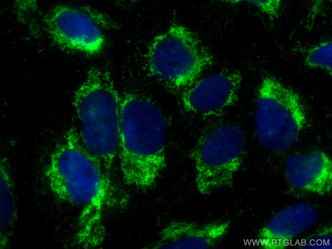 HIGD1A Antibody in Immunocytochemistry (ICC/IF)