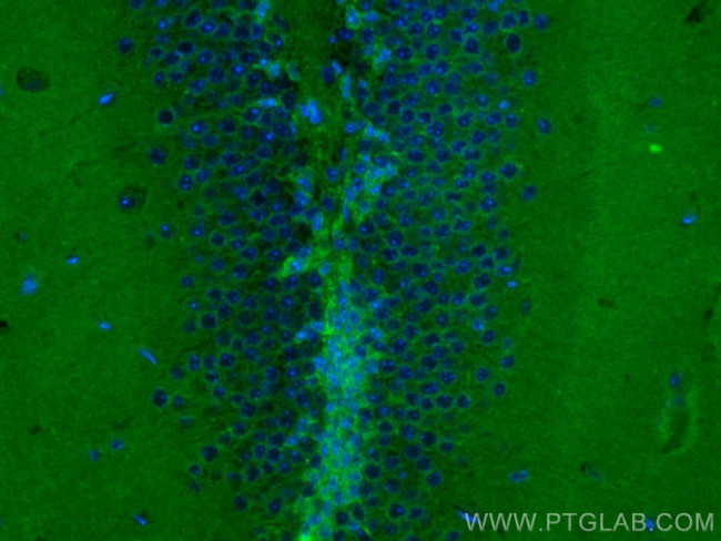 DCLK1 Antibody in Immunohistochemistry (PFA fixed) (IHC (PFA))