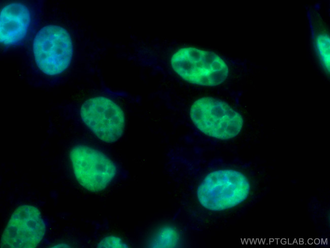HNRNPD Antibody in Immunocytochemistry (ICC/IF)