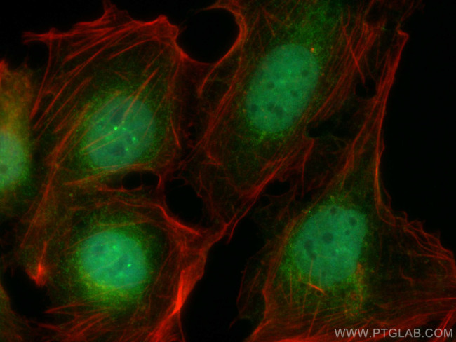 SNX15 Antibody in Immunocytochemistry (ICC/IF)