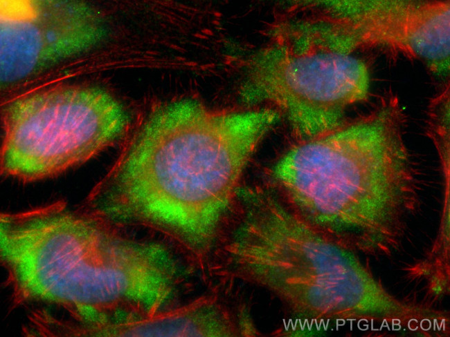 GLO1 Antibody in Immunocytochemistry (ICC/IF)