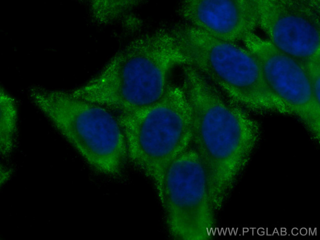 FBXO17 Antibody in Immunocytochemistry (ICC/IF)