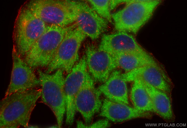 TPMT Antibody in Immunocytochemistry (ICC/IF)