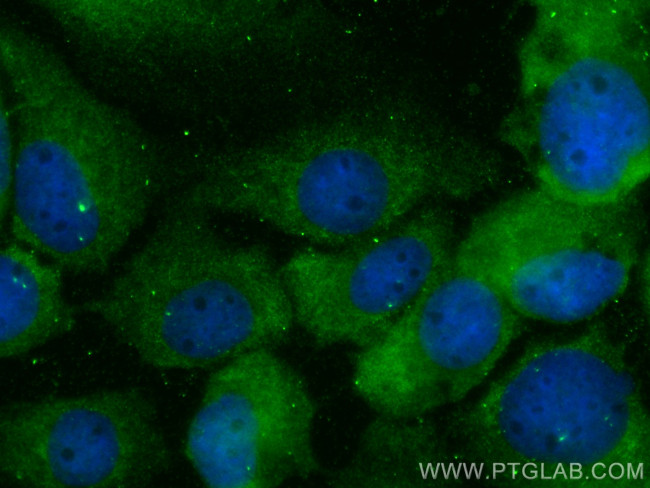 SNX9 Antibody in Immunocytochemistry (ICC/IF)