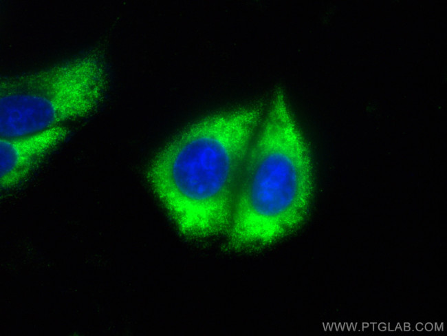 CARD11 Antibody in Immunocytochemistry (ICC/IF)