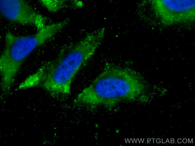 RPS20 Antibody in Immunocytochemistry (ICC/IF)