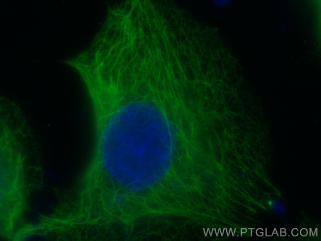 MAP4 Antibody in Immunocytochemistry (ICC/IF)
