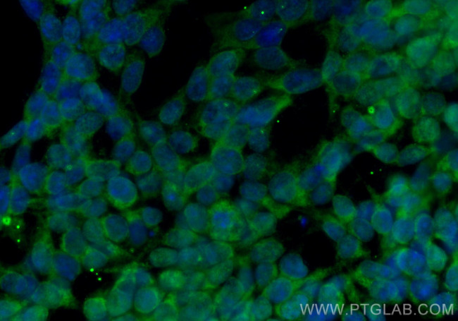 CRMP5 Antibody in Immunocytochemistry (ICC/IF)