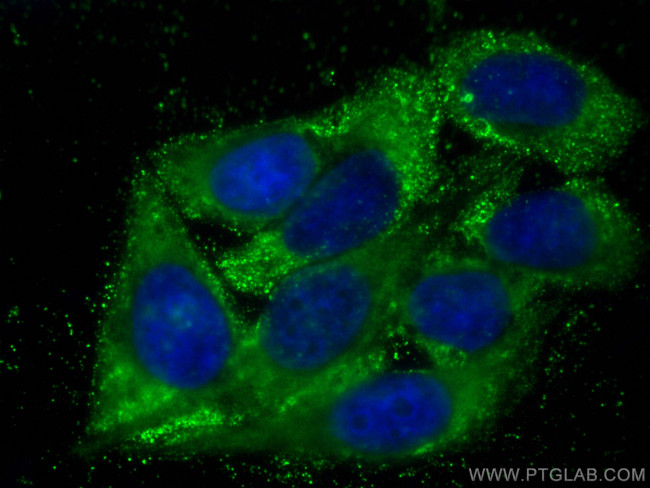 BDH2 Antibody in Immunocytochemistry (ICC/IF)