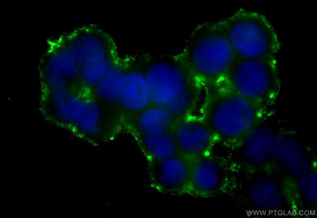 SERCA3 Antibody in Immunocytochemistry (ICC/IF)