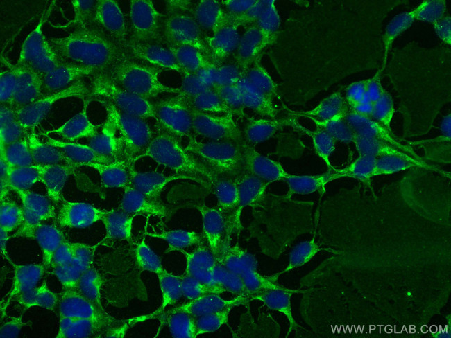 NRCAM Antibody in Immunocytochemistry (ICC/IF)
