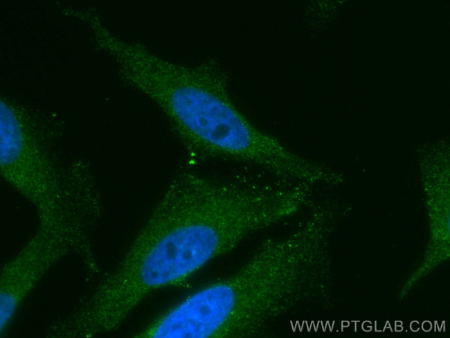 MICAL1 Antibody in Immunocytochemistry (ICC/IF)